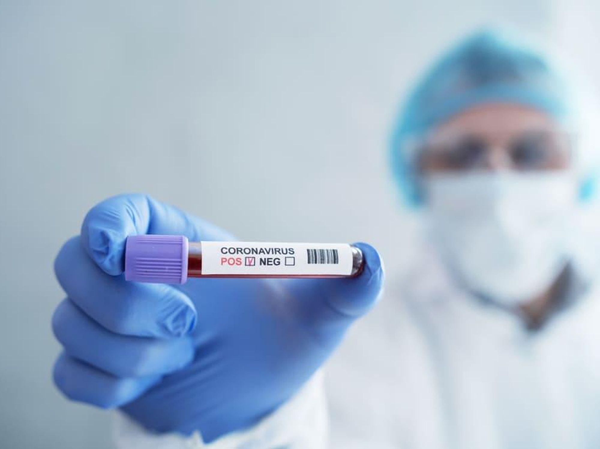 Coronavirus COVID-19 test