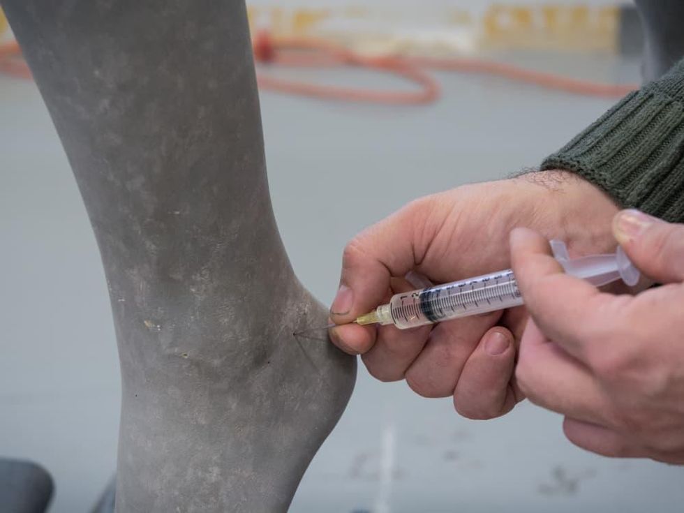 Diana restoration, Amon Carter Museum Fort Worth